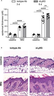 Neutrophils inhibit γδ T cell functions in the imiquimod-induced mouse model of psoriasis